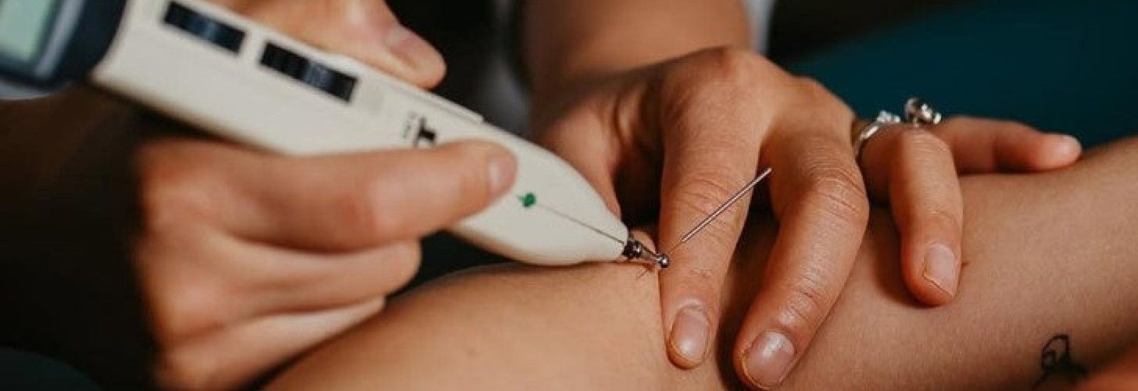 Electro-Therapy In Action: Applications, Case Studies & Tips & Tricks