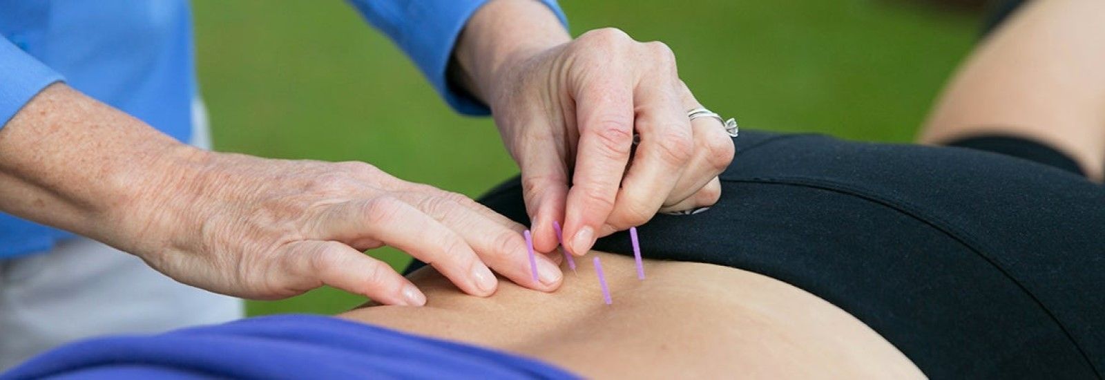 Ask Me Anything: Sports Acupuncture Featuring Whitfield Reaves, Dr. Jenny Nieters, Vincent Koeller, and Derrick McBride