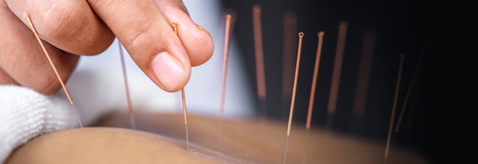 When Ashi Point Needling Doesn't Work! Featuring Matt Callison, Brian Lau, and Ian Armstrong