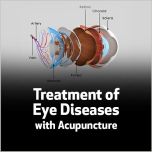 Treatment of Eye Diseases with Acupuncture